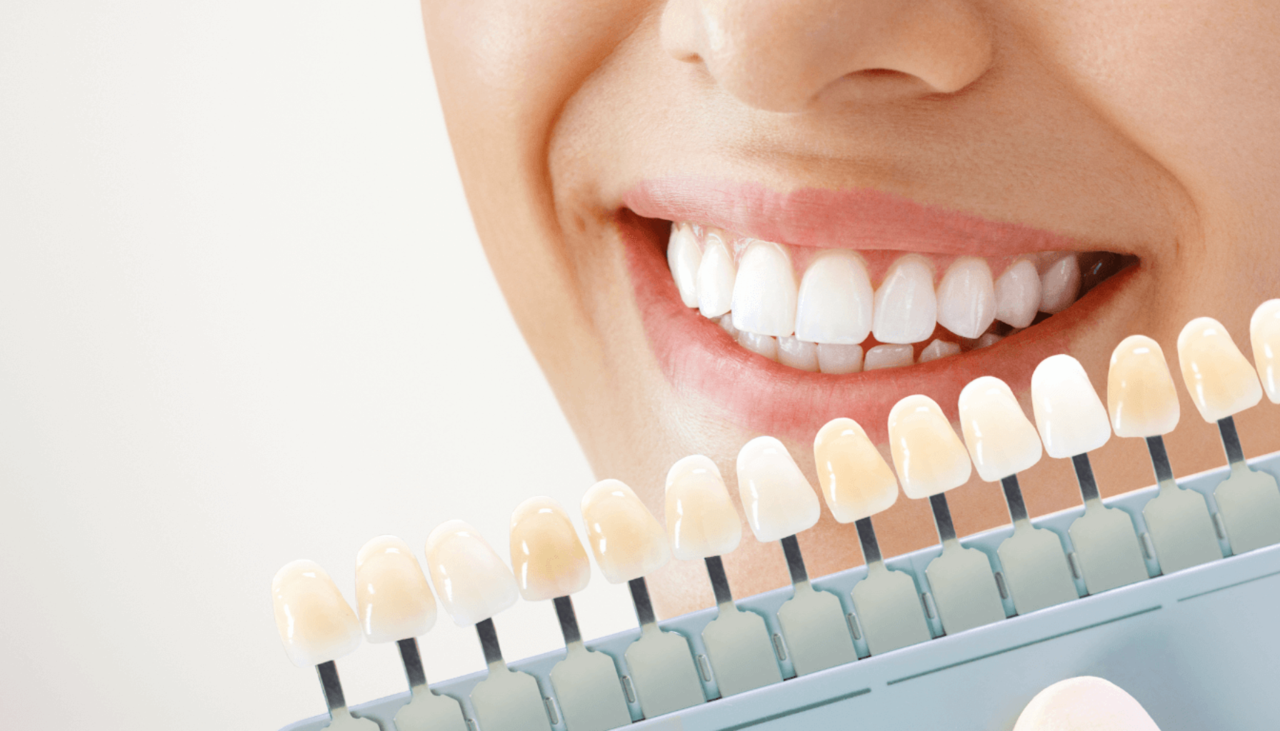 En nærbilde av en smilende kvinne med hvite tenner, som holder en tannfargeskala for å sammenligne nyanser av tannbleking.