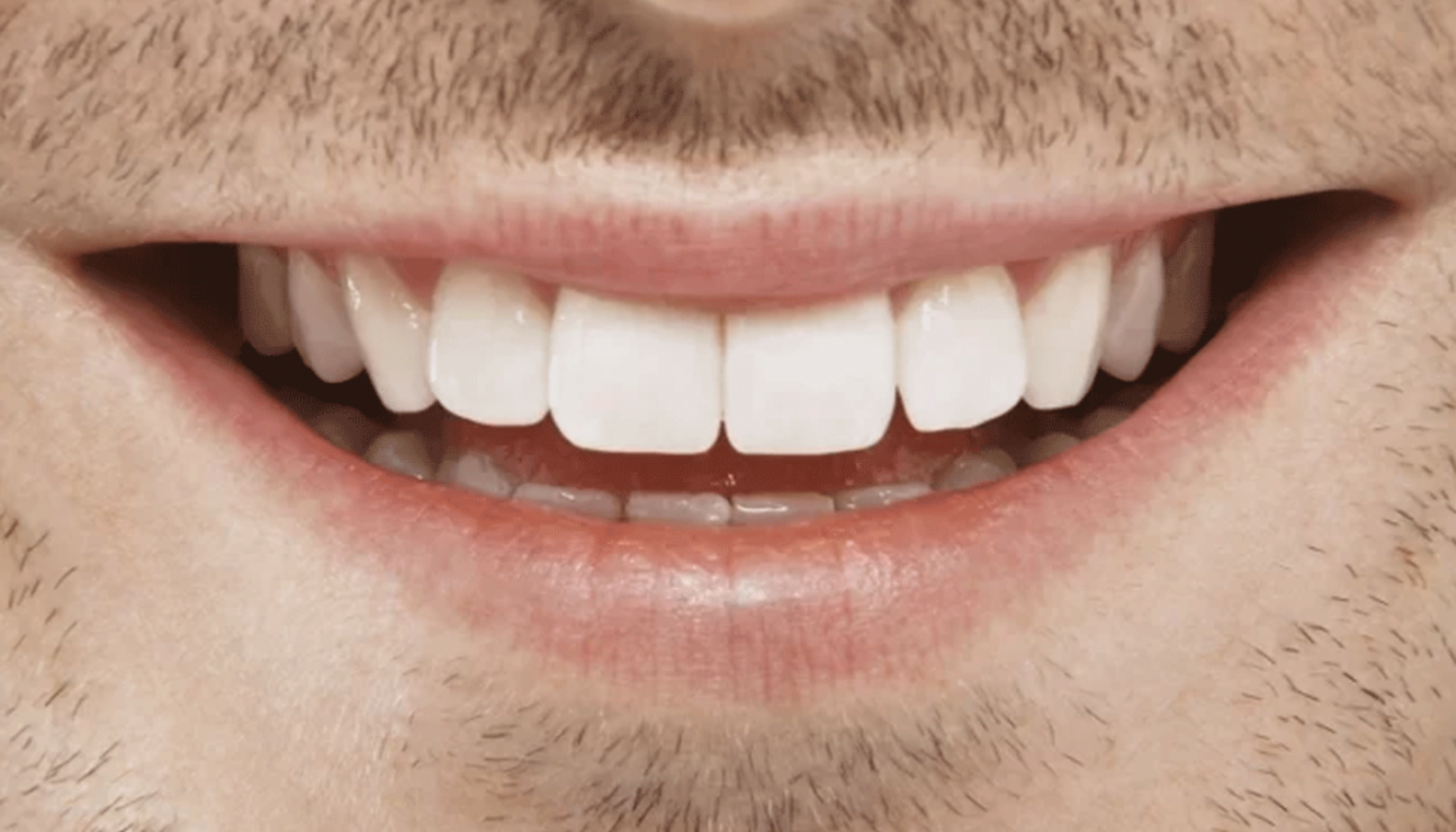 Nærbilde av en smilende mann med hvite tenner og lett skjeggvekst, som viser god tannhelse og en sunn munn.