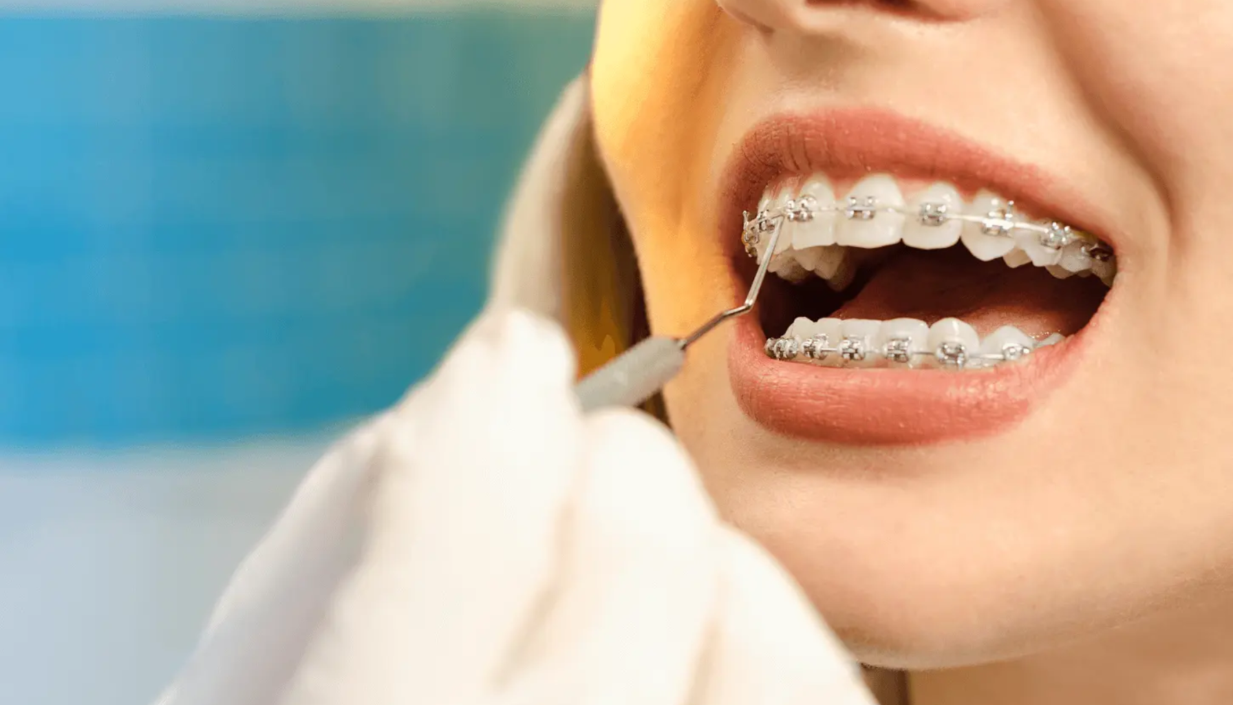 Tannlege sjekker pasients regulering med et verktøy. Nærbilde av munn med tannregulering i en tannklinikk. må betale fyller 20 år hos tannlegen trenger regulering usynlig regulering