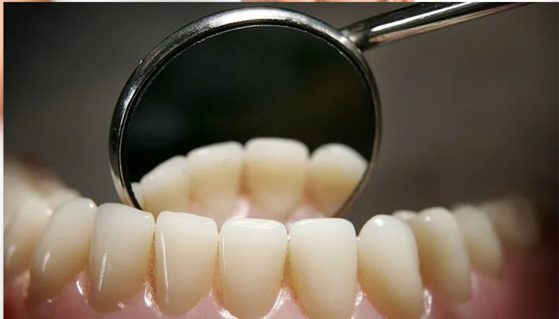 Nærbilde av en tannlege speil som reflekterer tennene under en tannundersøkelse, med fokus på sunne, hvite tenner og tannpleie.