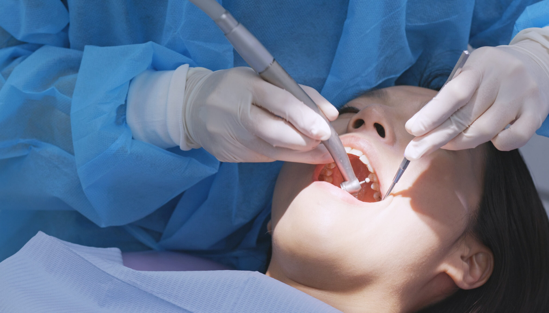 Fyllingsmaterialer tenner: Velge riktig materiale for din tannhelse