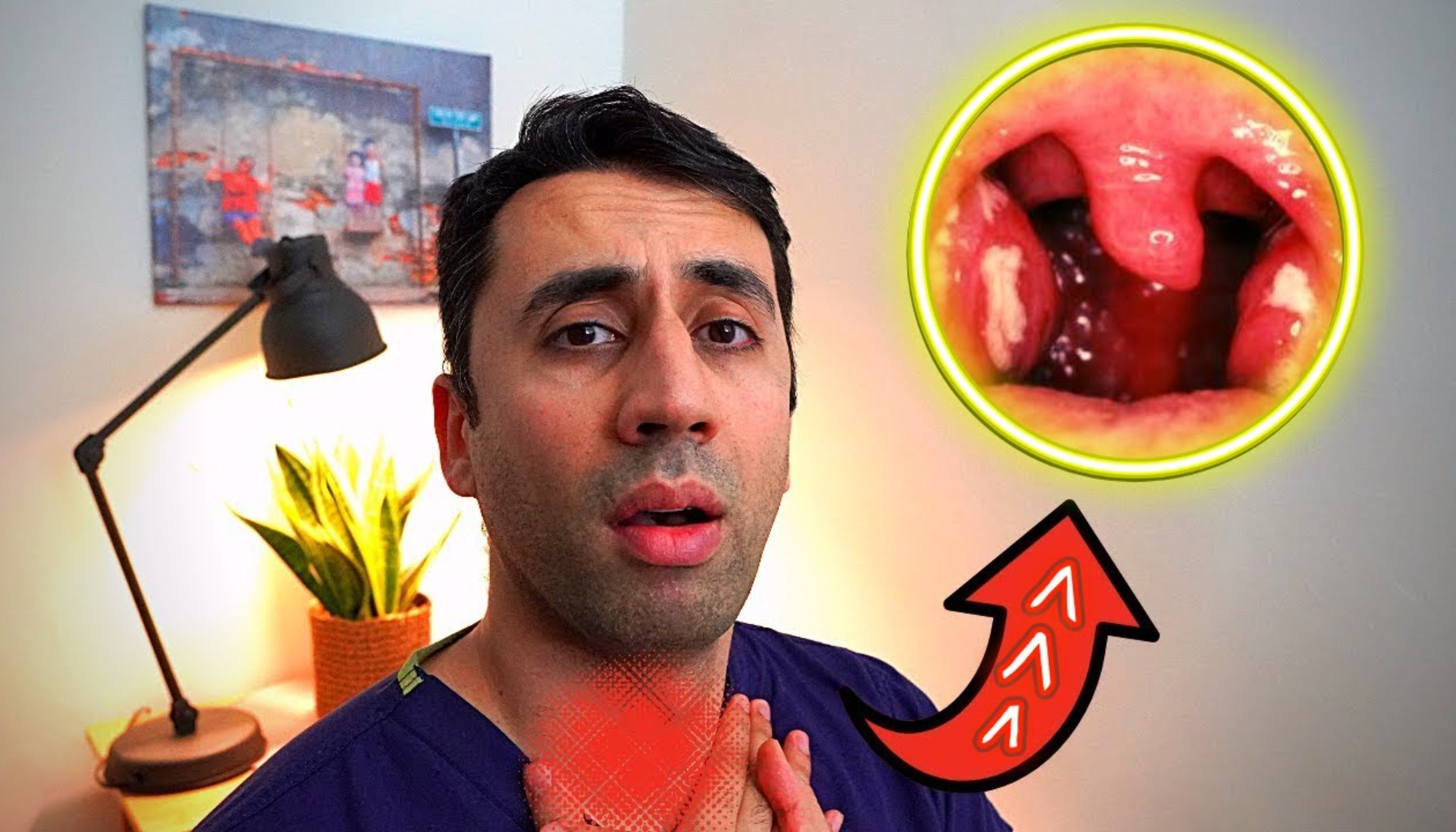 Mann med bekymret uttrykk holder seg på halsen, med illustrasjon av infisert svelg og betente mandler i sirkel øverst til høyre.