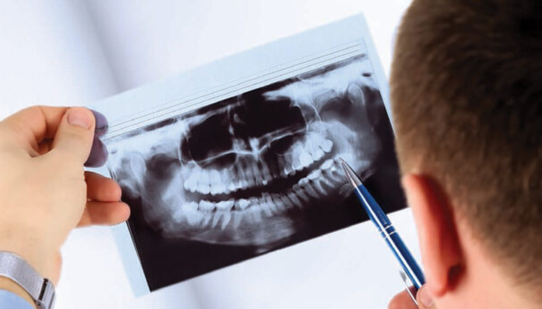 Tannresorpsjon: Den Skjulte Trusselen mot Tenner